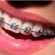 dentes lindos