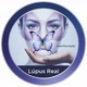 lupus real