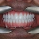 Digital Dental Implants