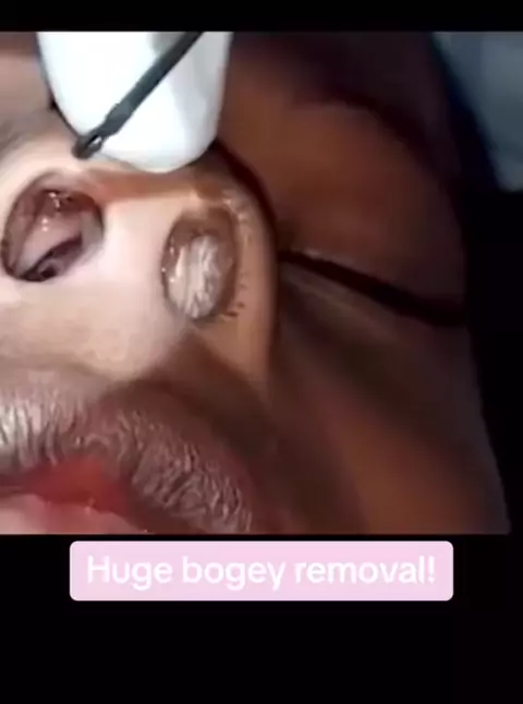 Candid hd noodlemagazine